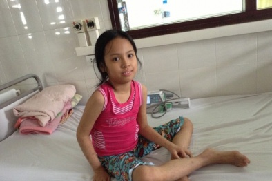 Bệnh nhân mắc sởi biến chứng đã được cứu sống